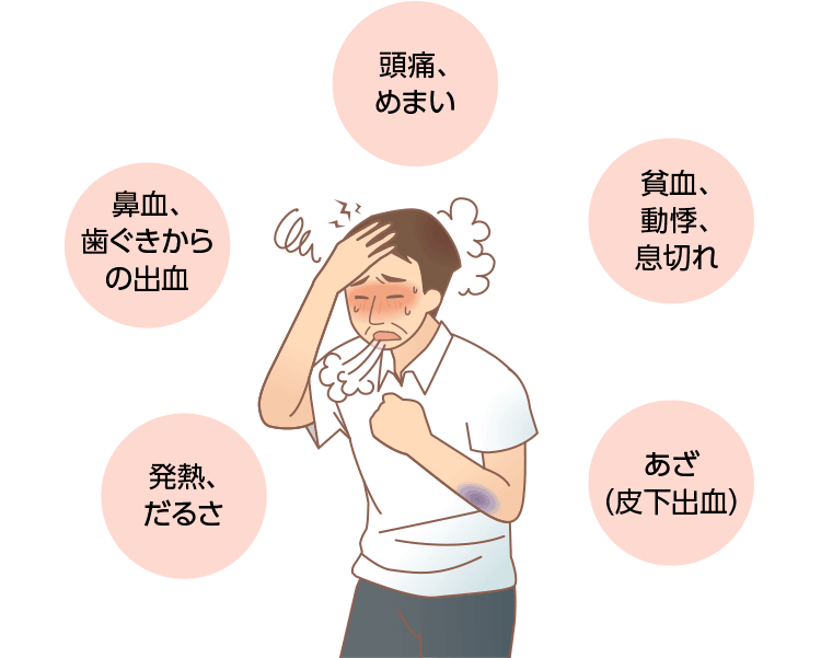 急性リンパ性白血病の症状は頭痛、めまい、貧血、息切れ、動悸、あざ（皮下出血）、出血、鼻血、発熱、だるさが挙げられます