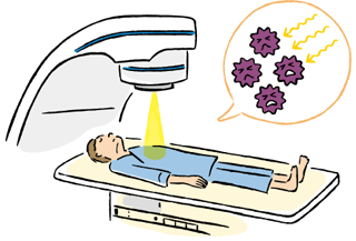 肺がん治療と副作用～放射線療法と副作用｜肺がんを学ぶ｜がんを学ぶ