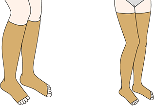 図：弾性ストッキング（靴下タイプ）2種（膝下のもの、太ももまでのもの）