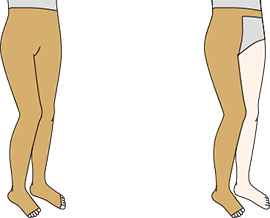 図：弾性ストッキング（靴下タイプ）2種（膝下のもの、太ももまでのもの）