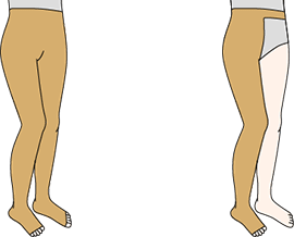 図：弾性ストッキング（タイツタイプ）2種（両足用、片足用）